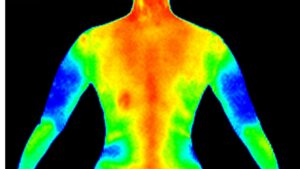 Thermography